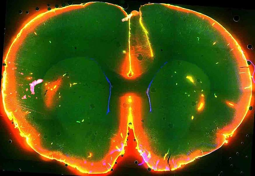 Deep Dive into Dementia 