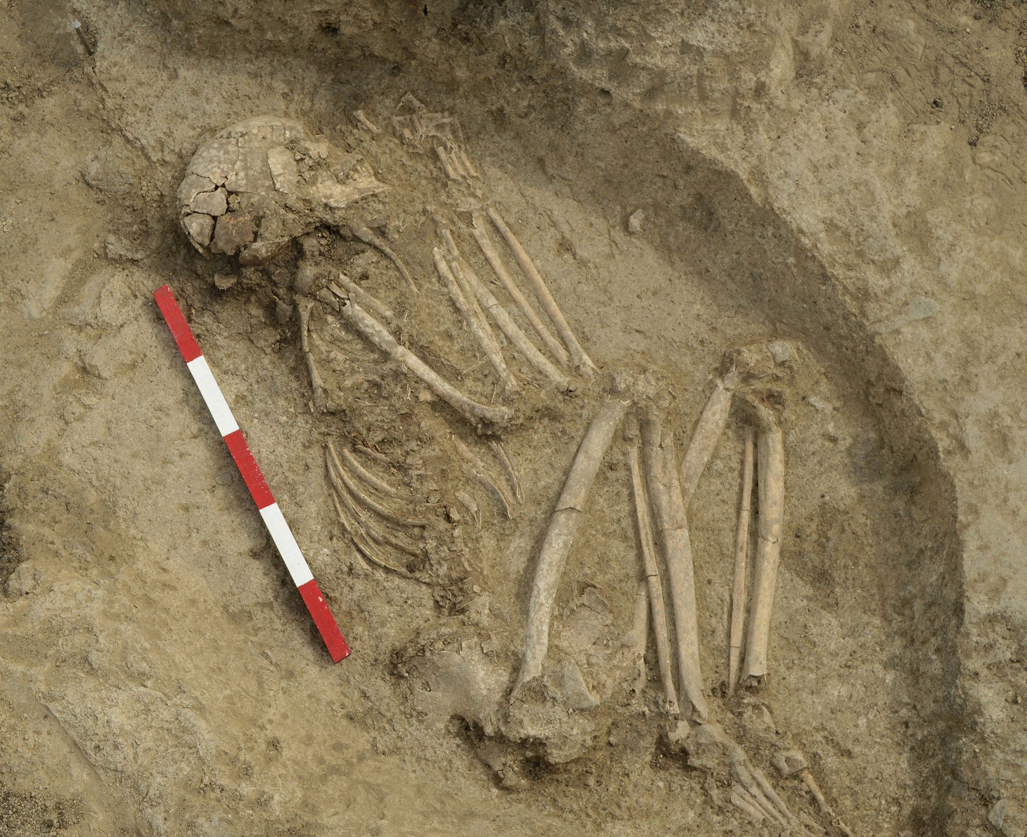 He Was Attacked by a Lion 6,200 Years Ago. His Community Kept Him Alive.