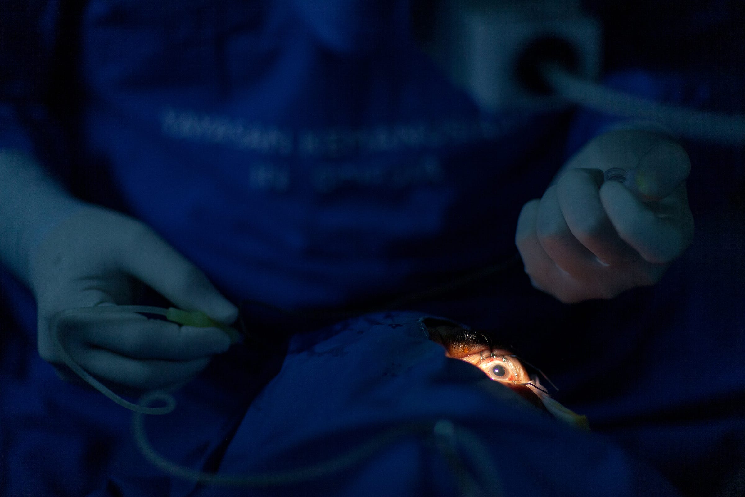 An ultrasonic probe breaks up the cloudy lens An ultrasonic probe breaks up the cloudy lens