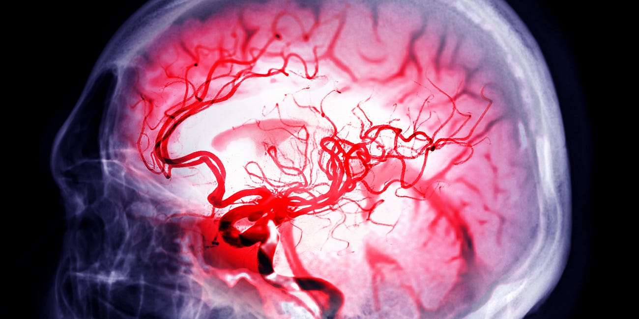 Should thrombolytics be given >4.5 hours after stroke onset?