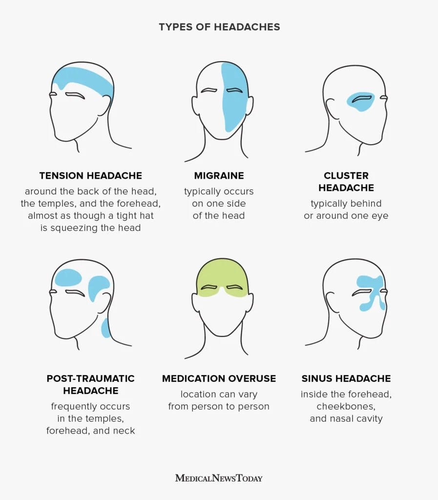 Headache chart: Types by symptoms, location, and causes