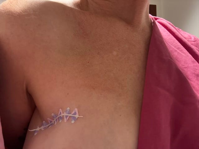 What it's Like to Find Out You Have Cancer, Part 4
