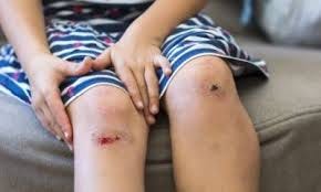 Skinned Knees and Elbows: How to Raise Resilient Children - Ask The  Scientists