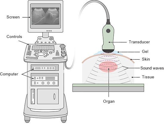 How do ultrasound examinations work? | informedhealth.org