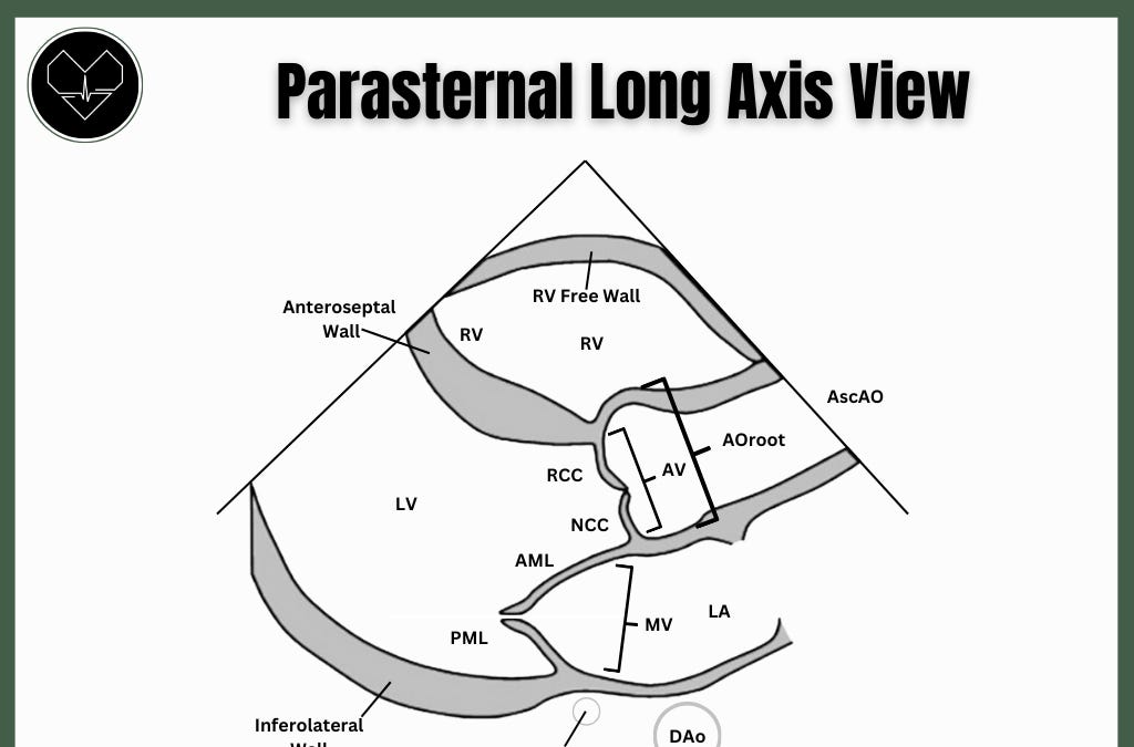 How To Get A Parasternal Long Axis Image By Aram K How To Get A Parasternal Long Axis Image By Aram K