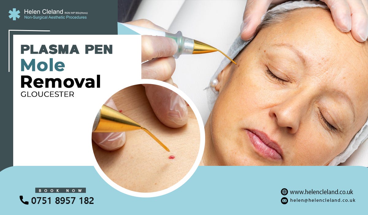 Plasma pen mole removal Gloucester