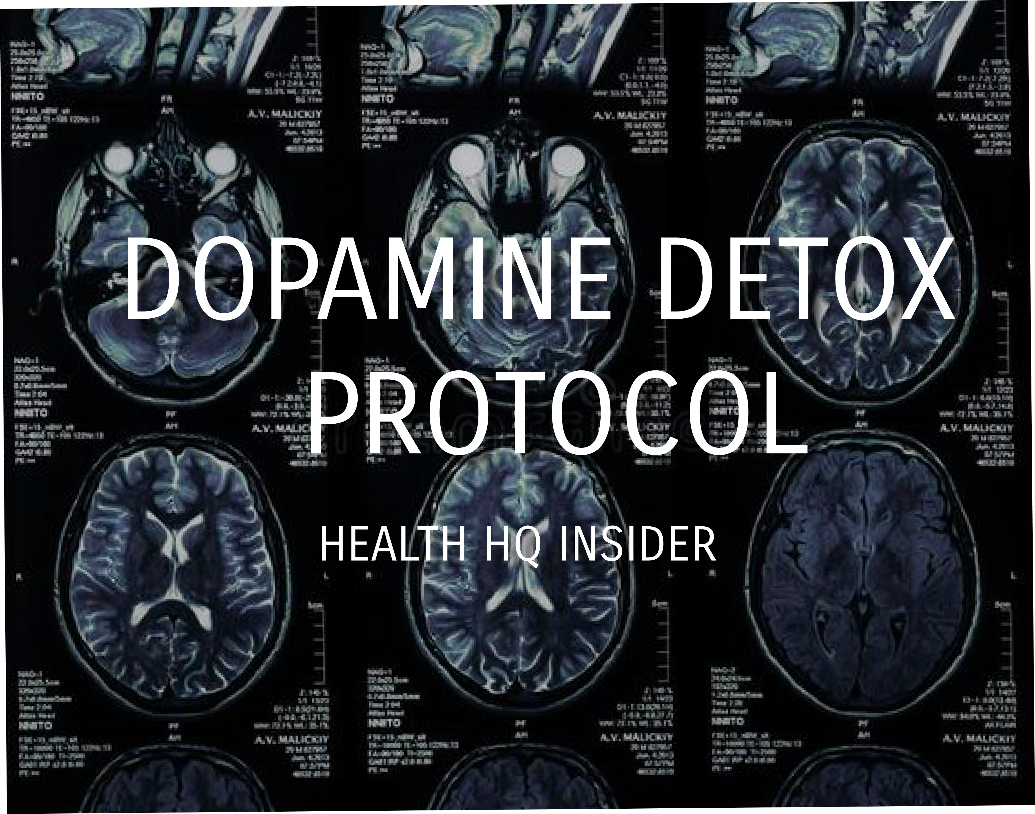 The Ultimate Guide to Dopamine Detox - by Noah Ryan