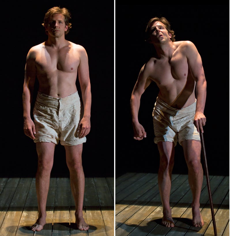 Review: Bradley Cooper's “Elephant Man” began in Berkshires, a hit on  B'way, now in London