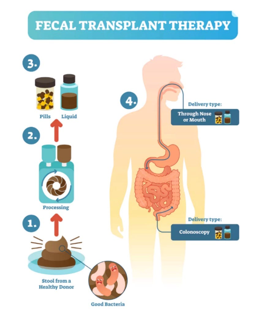 Fecal Transplantation: Science's Dirty Secret - Omixon