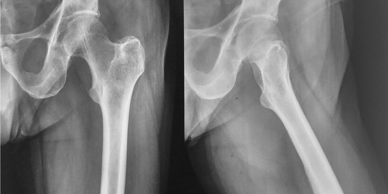 Case 1: Common Tumors Occur Commonly