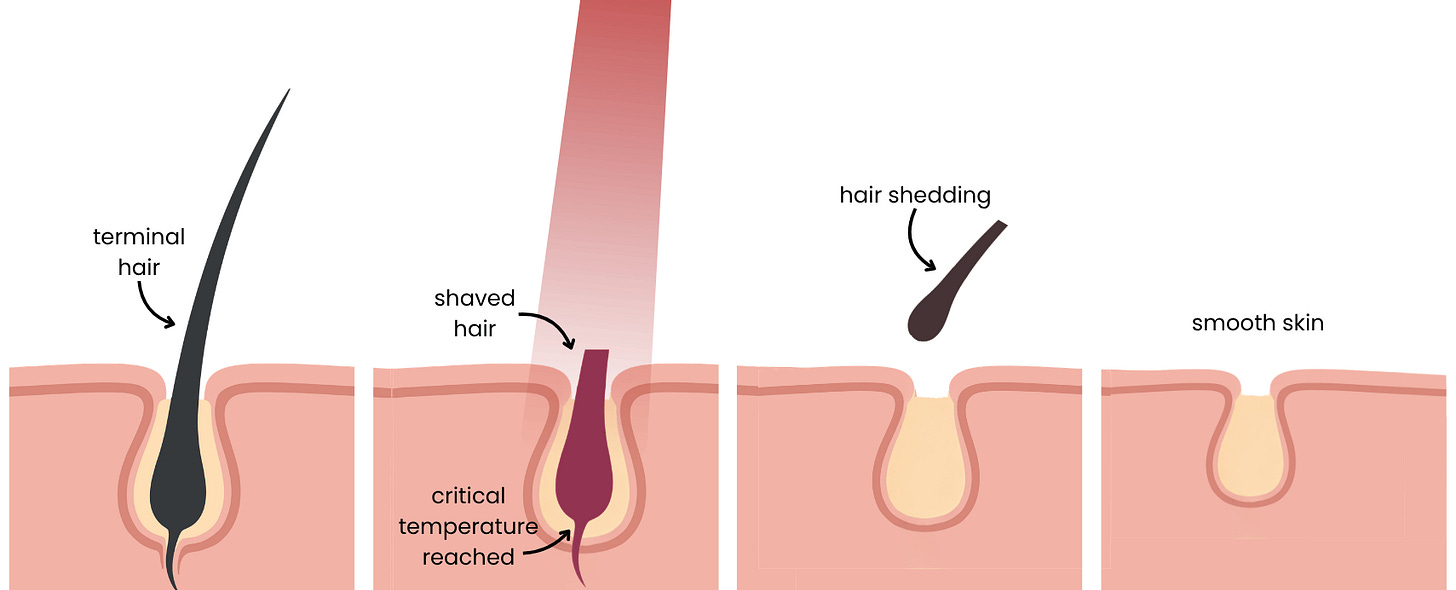 The Science of Selective Photothermolysis