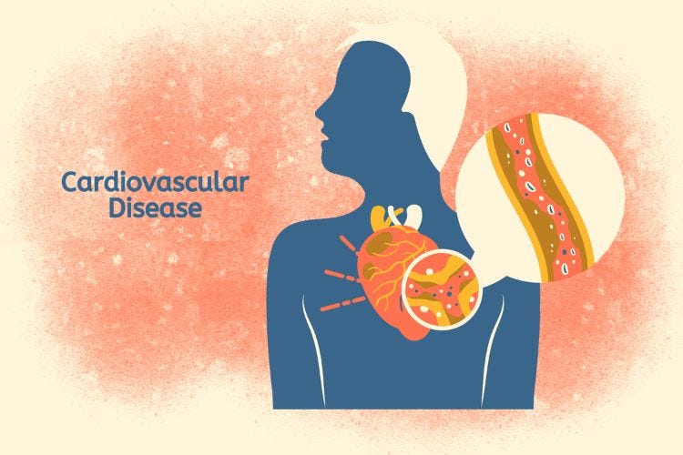 Cardiovascular Disease