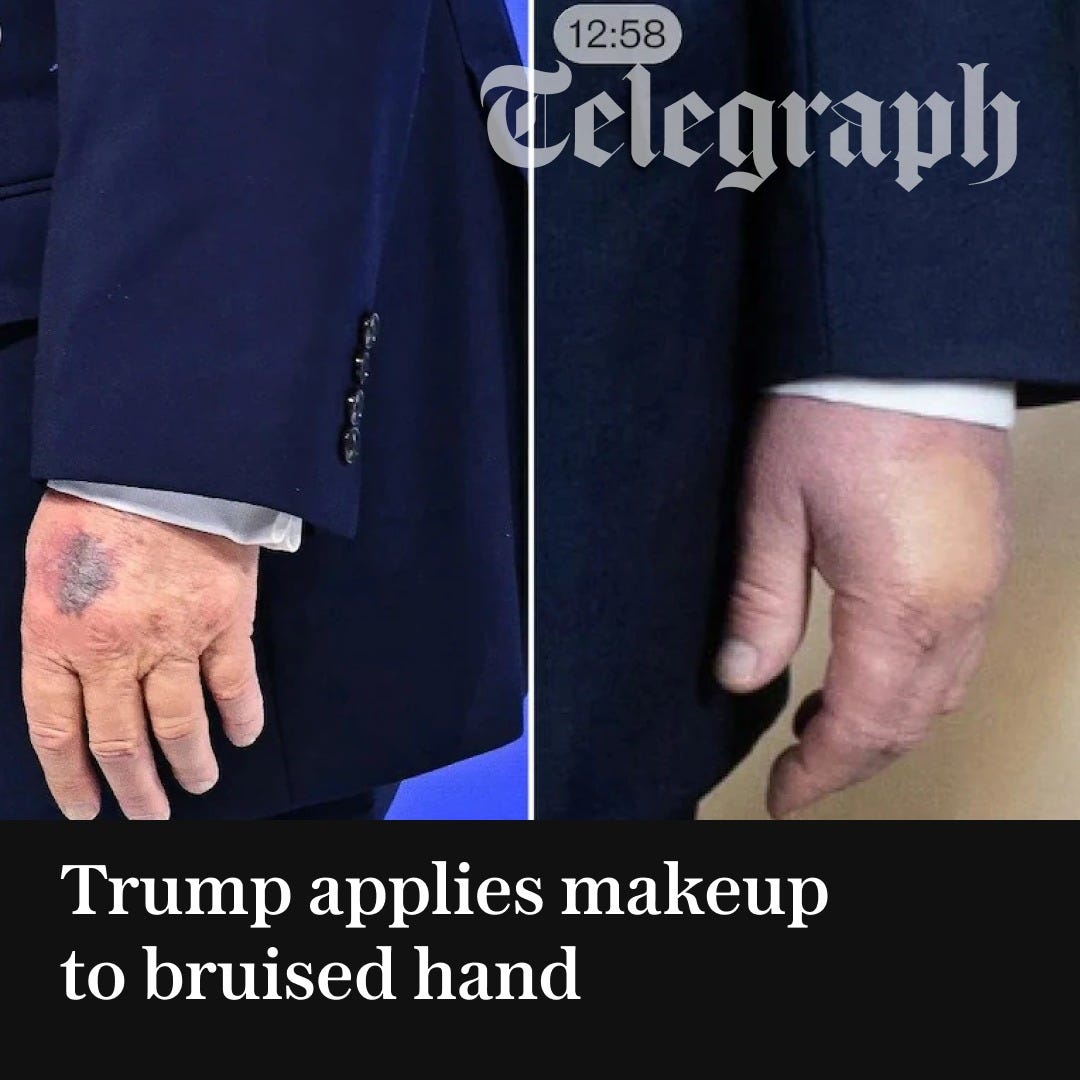 May be an image of text that says '12:58 Celegraph Trump applies makeup to bruised hand' May be an image of text that says '12:58 Celegraph Trump applies makeup to bruised hand'