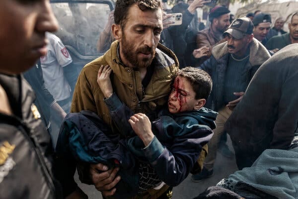 A man carries a child who has a bloody face.