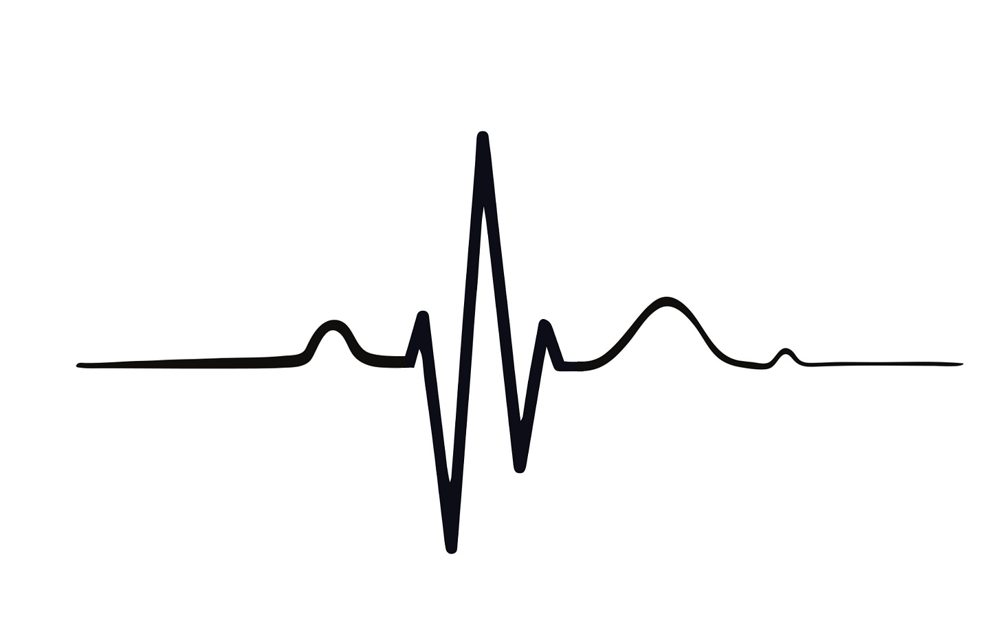 qrs*° QRS Interval • LITFL • ECG Library Basics