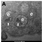 Persistent Detection of Vaccine modRNA? A Parsimonious Hypothesis