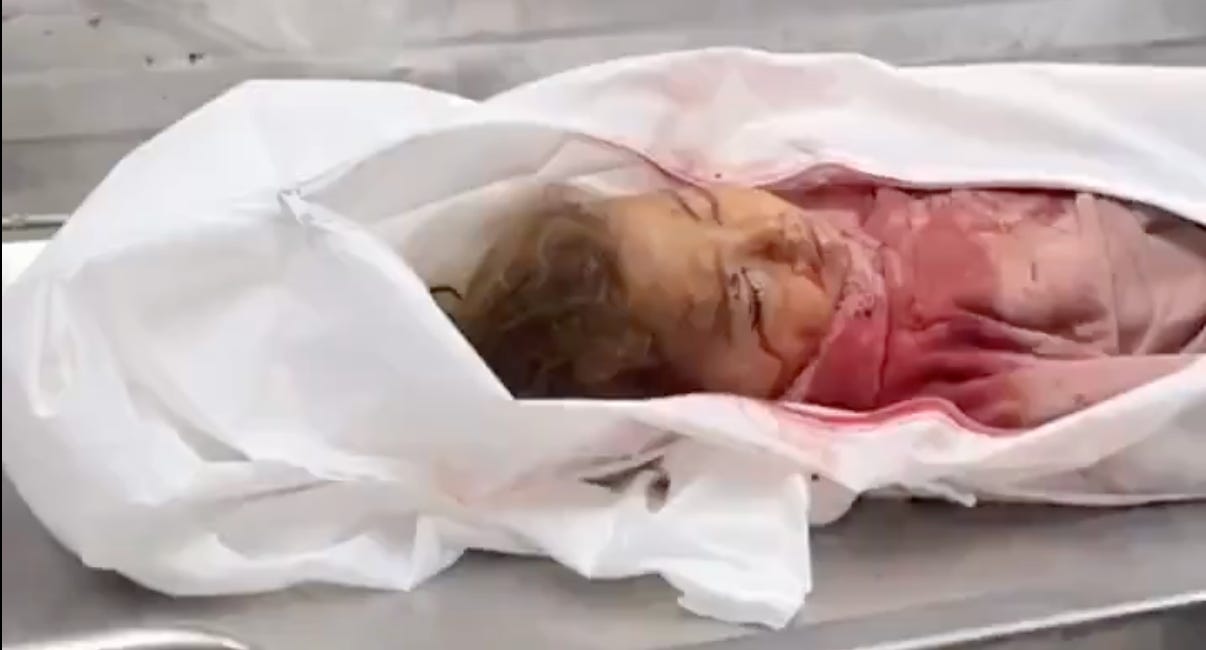 💔 The 3 Year Old Girl They Called a “Terrorist”