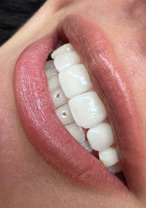 tooth gems kolathetoothfairy