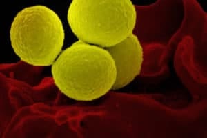 Scanning electron micrograph of a human neutrophil ingesting MRSA