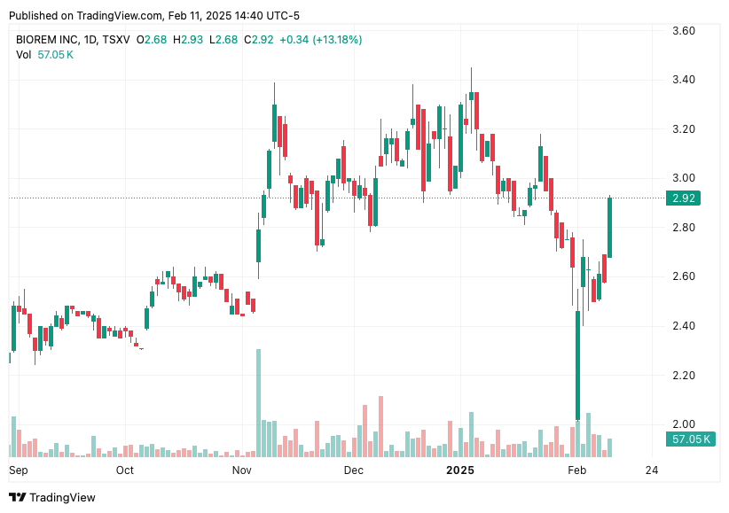 TradingView chart