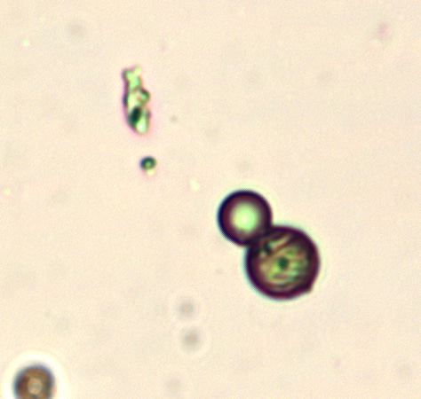 Various Microcapsules taken from various samples using a lab grade LeicaDM2000 microscope at 25x objective and enlarged significantly