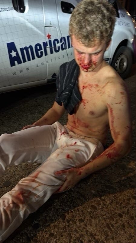 Young man bloodied on street
