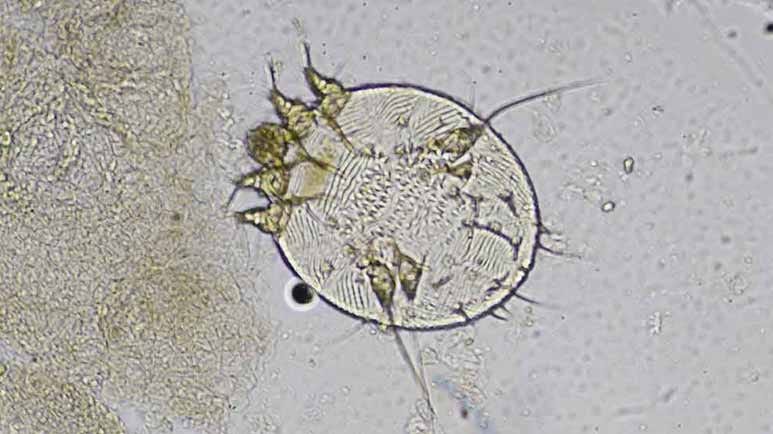 scabies recent comeback