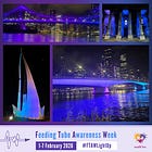 Gold Coast landmark will glow purple for Feeding Tube Awareness Week