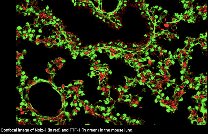 Research on Brain-Nerve Uncovers Key Lung Development Gene, Offering Insights into Tumor Formation and New Treatment Approaches