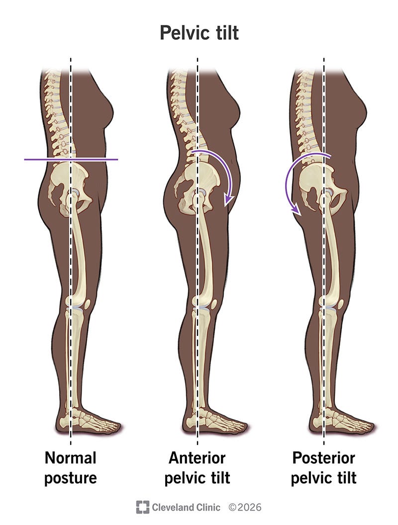 Pelvic Tilt: What It Is, Types, Causes & Symptoms