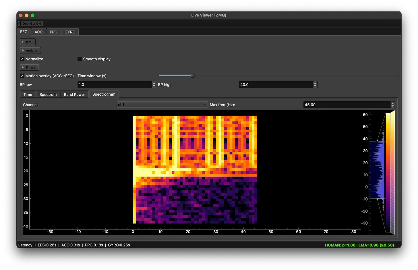 EEG Spectrogram Visualization