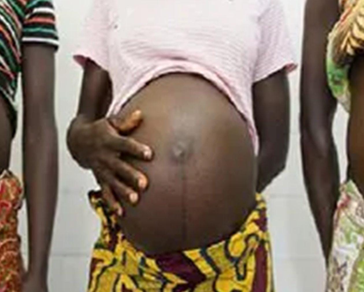 Whatever happens, don’t make her feel it’s the end of the road for her. She has her future before her and can still live her dreams after she’s had her baby.