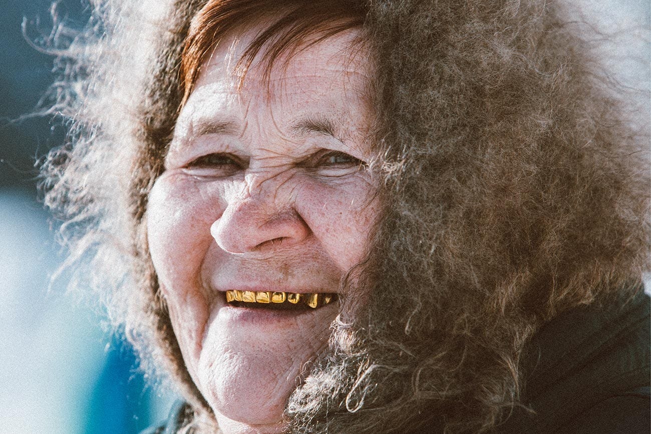 Why were gold TEETH so common in the USSR? (PHOTOS)