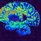 Covid effects in the pediatric brain