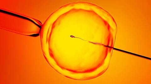 Getty Images Illustration of a sperm cell being injected into an egg during in vitro fertilisation (Credit: Getty Images)