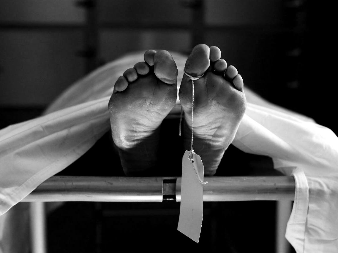 Catalepsy is a condition that makes you look like you are dead ...