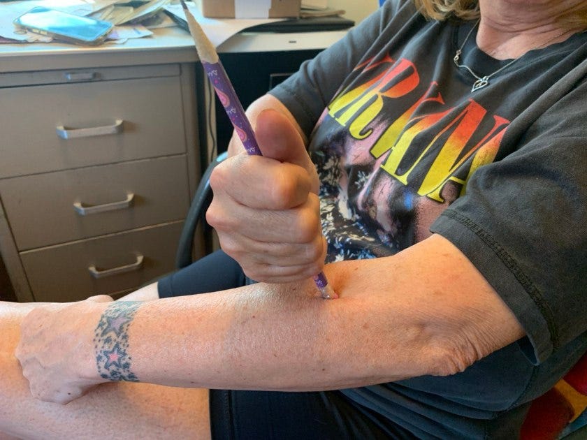 Simple Fix For Carpel Tunnel Syndrome