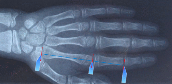 fibonacci hand fibonacci hand