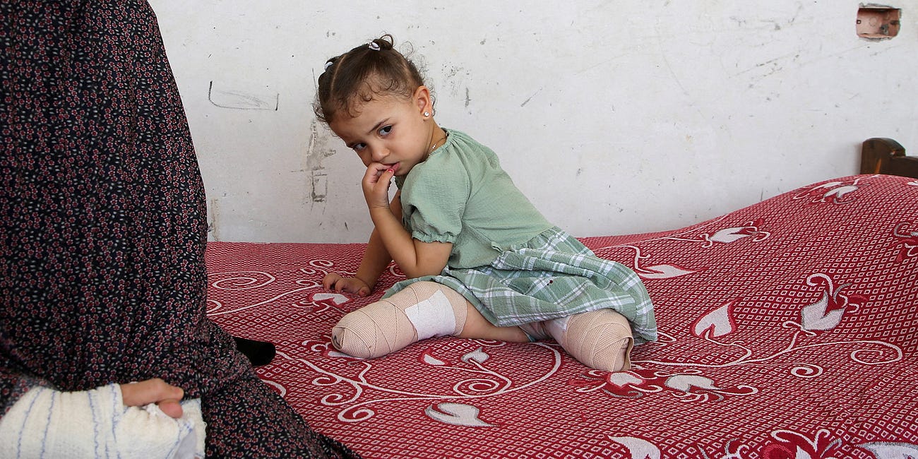 10 children are losing legs in Gaza every day