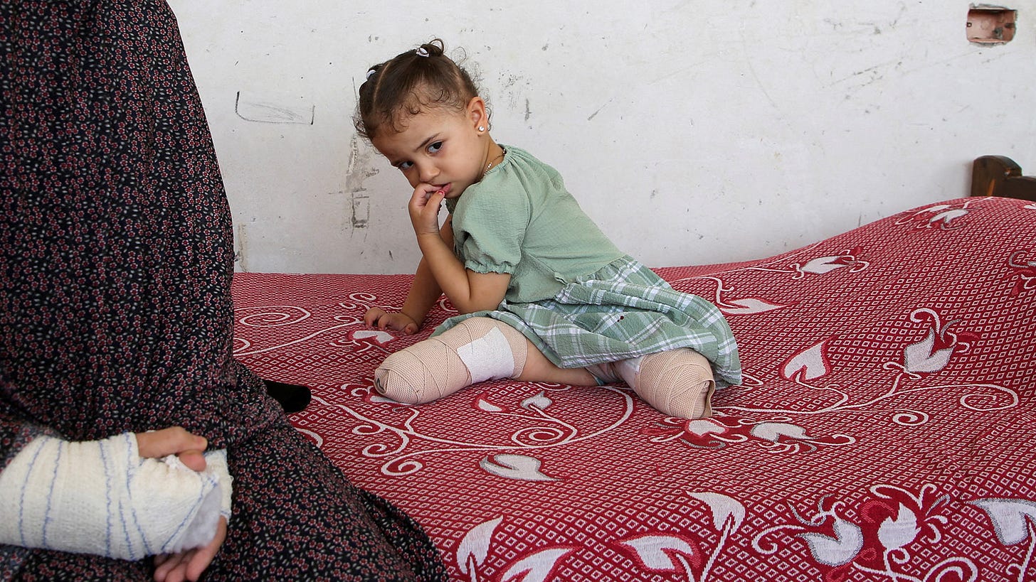 10 children are losing legs in Gaza every day - Palestine Will Be Free