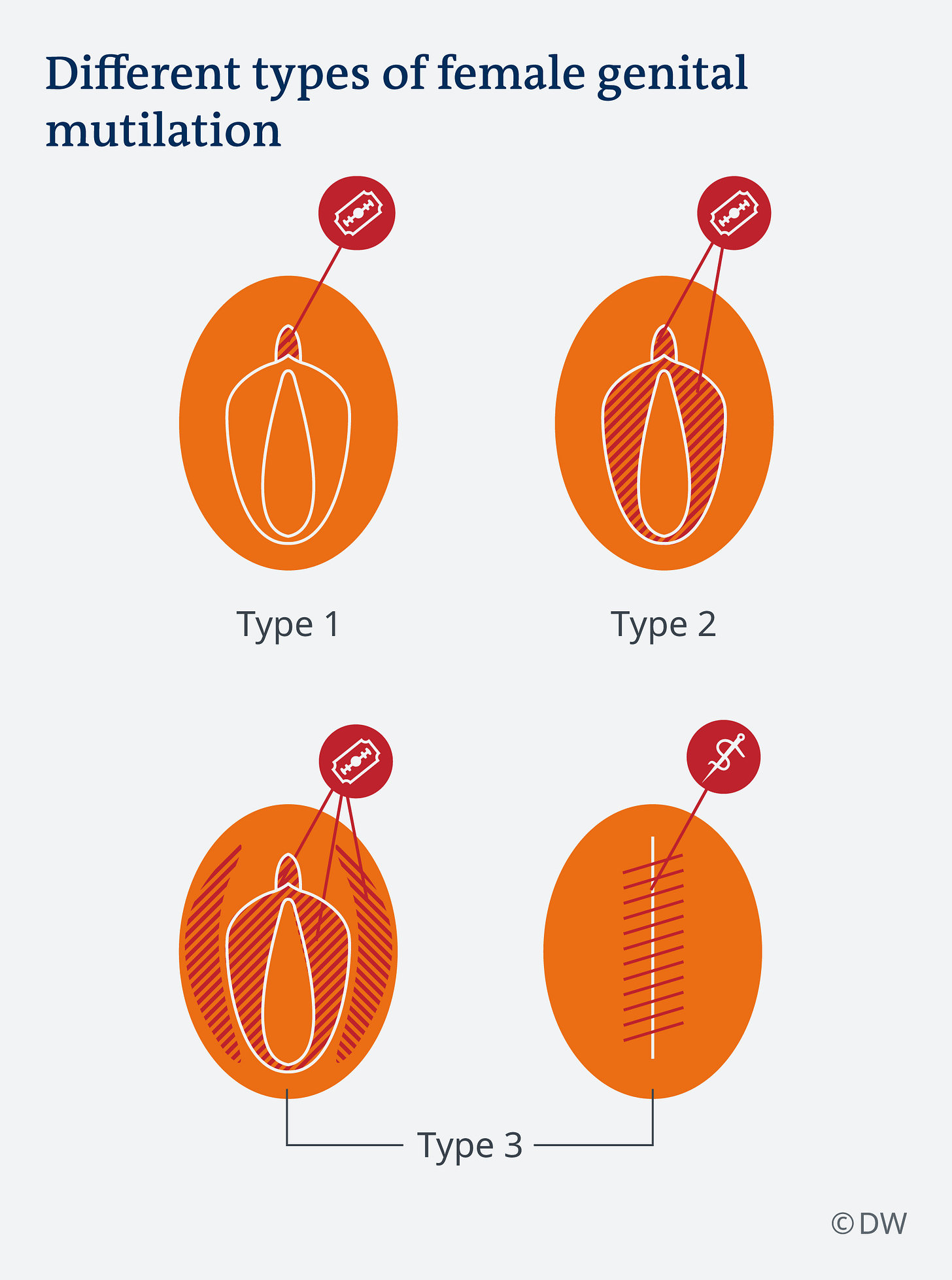 illustration of the four stages of FGM illustration of the four stages of FGM