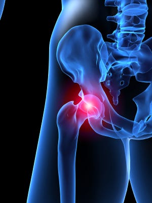 Hip Pain - Boise Spine Center