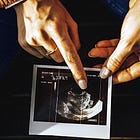 Πόσους ακριβώς σκότωσαν τα εμβόλια και πόσες γεννήσεις απέτρεψαν;