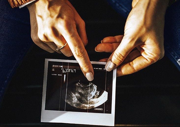 Miscarriage rates by week: Risks and statistics