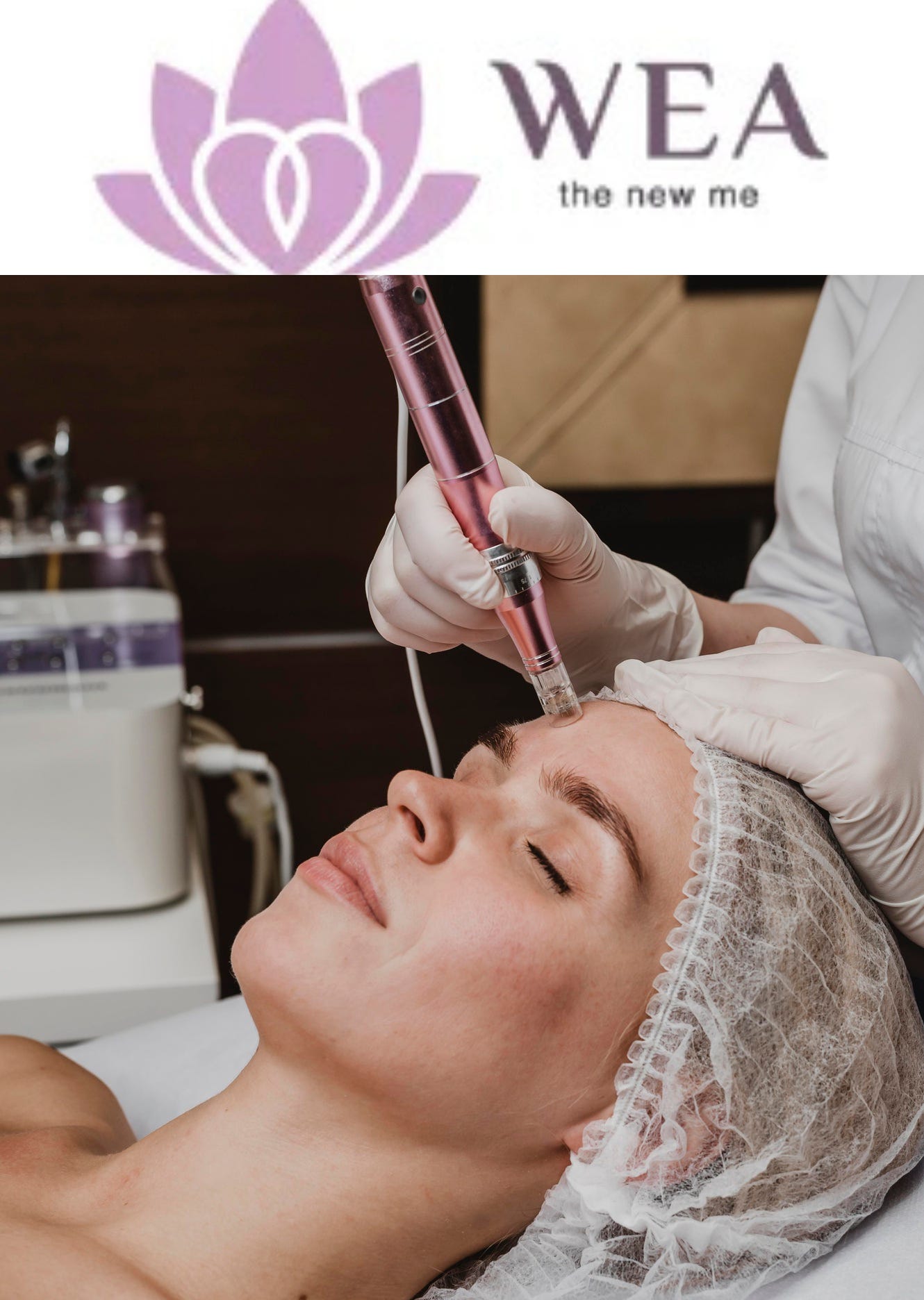 best skin clinic in chennai