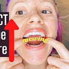 My official take on tongue posture