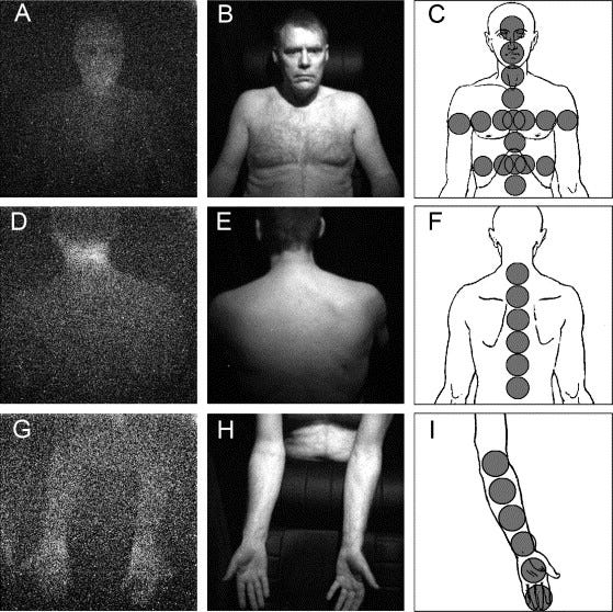 Anatomic characterization of human ultra-weak photon emission with a  moveable photomultiplier and CCD imaging - ScienceDirect