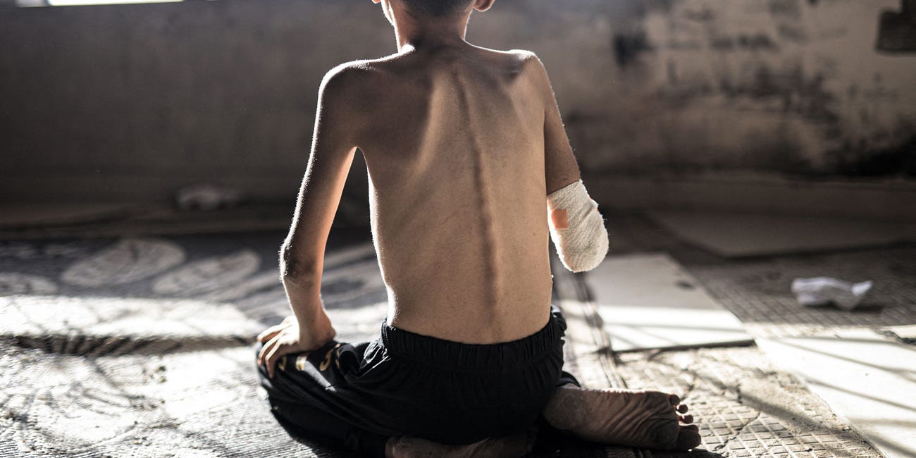 Gaza will be the stain on the soul of a generation of leaders who chose to look the other way