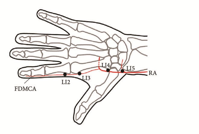 Acupuncture Point “Hegu” (LI4) Is Close to the Vascular Branch from the  Superficial Branch of the Radial Nerve - Umemoto - 2019 - Evidence-Based  Complementary and Alternative Medicine - Wiley Online Library
