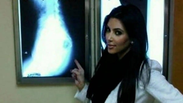 kim kardashian xray of butt for fans 2012 kim kardashian xray of butt for fans 2012